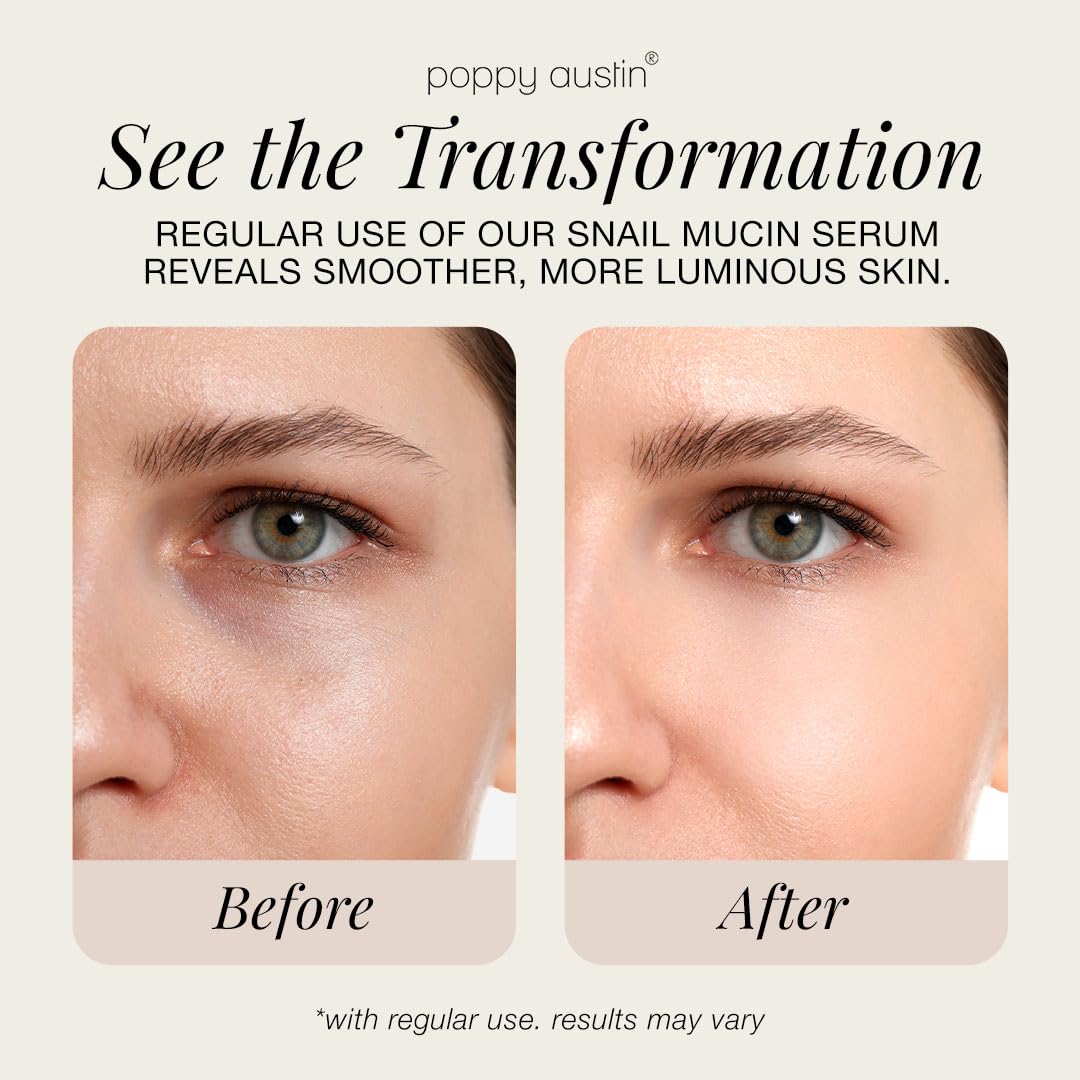 96% Snail Mucin Face Serum with Niacinamide & Hyaluronic Acid