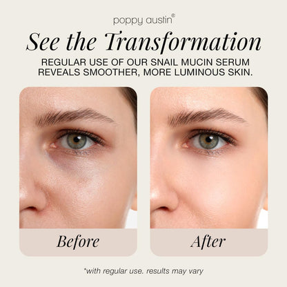 96% Snail Mucin Face Serum with Niacinamide & Hyaluronic Acid