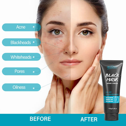 Charcoal Peel-Off Blackhead Remover Mask Kit with Tools
