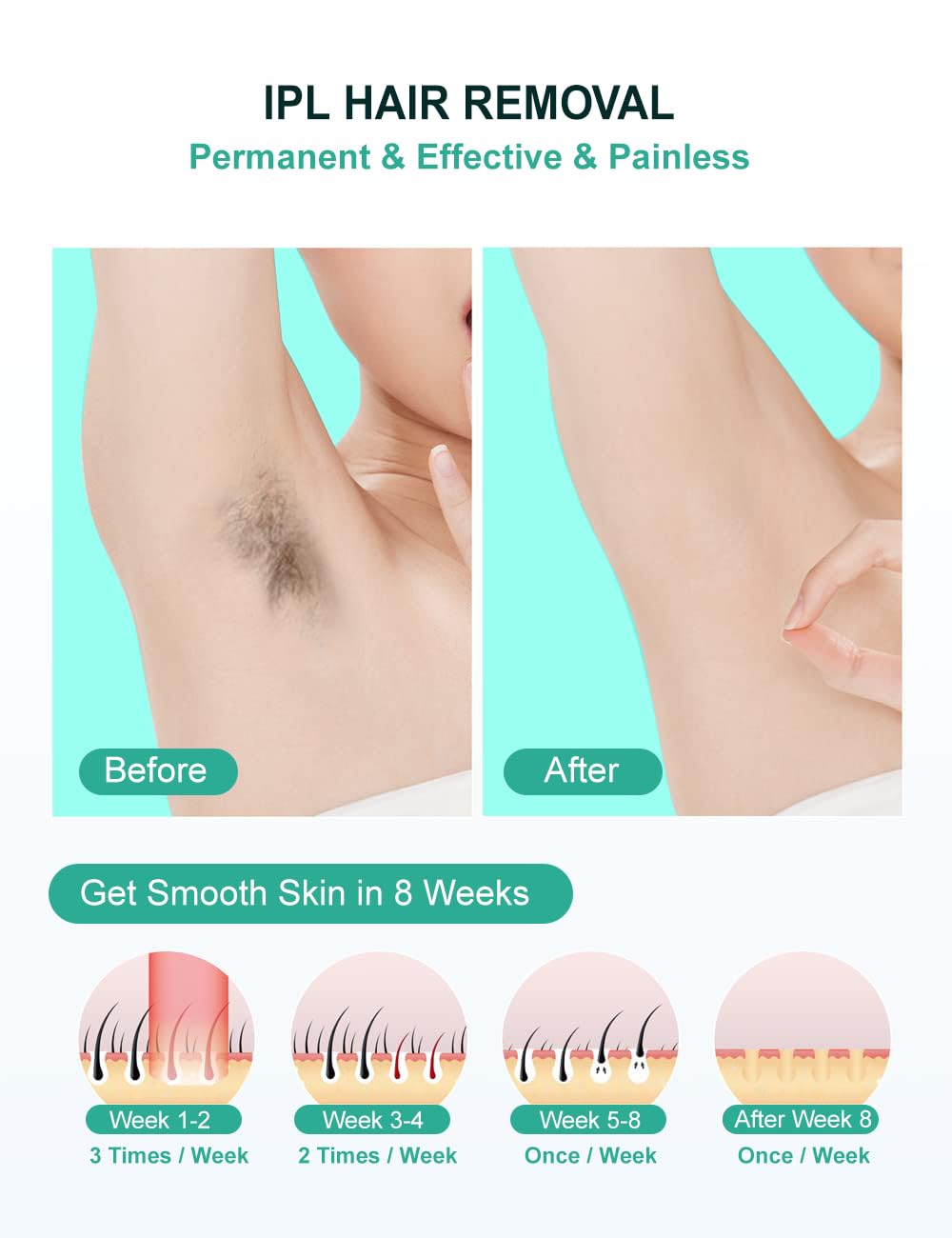 At-Home IPL Hair Removal Device with 999,999 Flashes