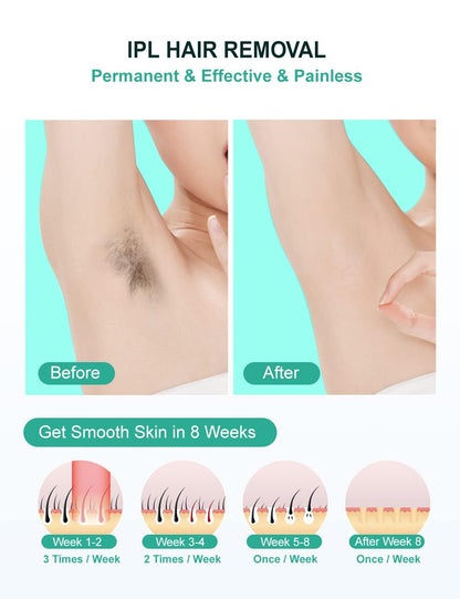 At-Home IPL Hair Removal Device with 999,999 Flashes