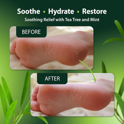 Tea Tree Foot & Body Oil for Dry Skin and Cracked Heels