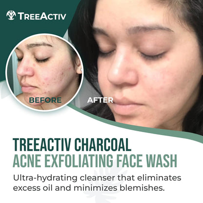 Charcoal & Sulfur Face Wash for Acne-Prone Skin